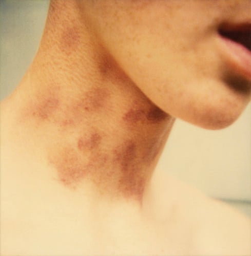 Mike Brodie,  Hickeys on my neck, c. 2004-2006